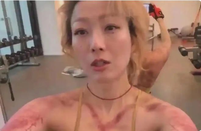 郑秀文刚刮完痧晒健身照这个自律的女人身材匀称状态佳(图3)