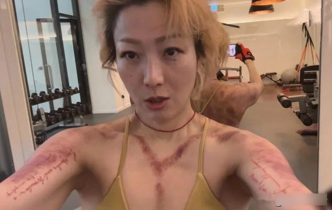 郑秀文刚刮完痧晒健身照这个自律的女人身材匀称状态佳(图1)