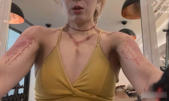 郑秀文刚刮完痧晒健身照这个自律的女人身材匀称状态佳(图2)